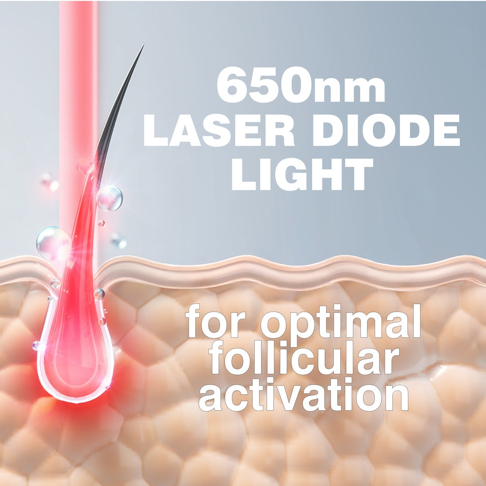 Illustration shows the Rio HairGrow Laser Head Band’s 650nm laser diode light targeting hair follicles, highlighting the power of red light therapy for effective hair regrowth over a microscopic view of skin tissue.