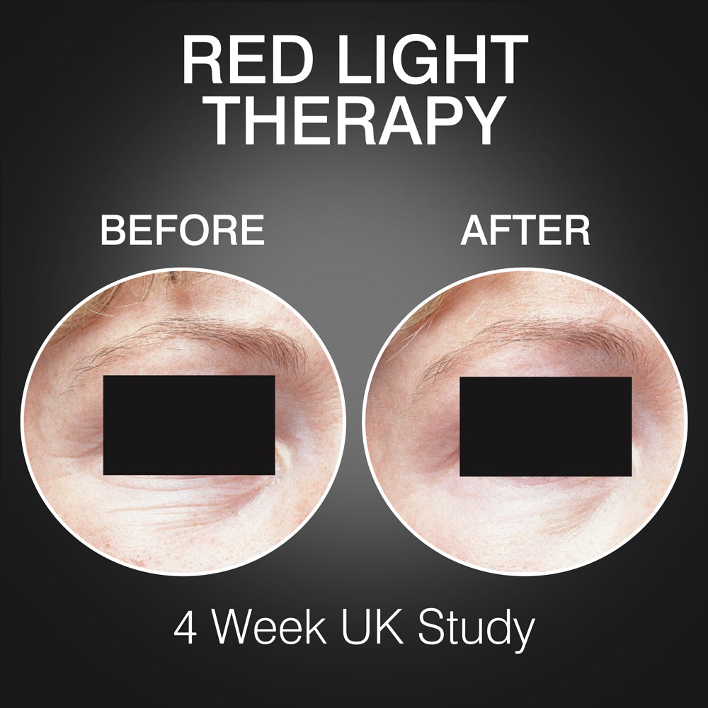 Side-by-side close-ups of skin around an eye, labeled Before and After using Rio’s FaceGLO with Photology Chlorophyll Light Masque. Shows reduced wrinkles after 4 weeks in a UK study. Text: Red Light Therapy and 4 Week UK Study.