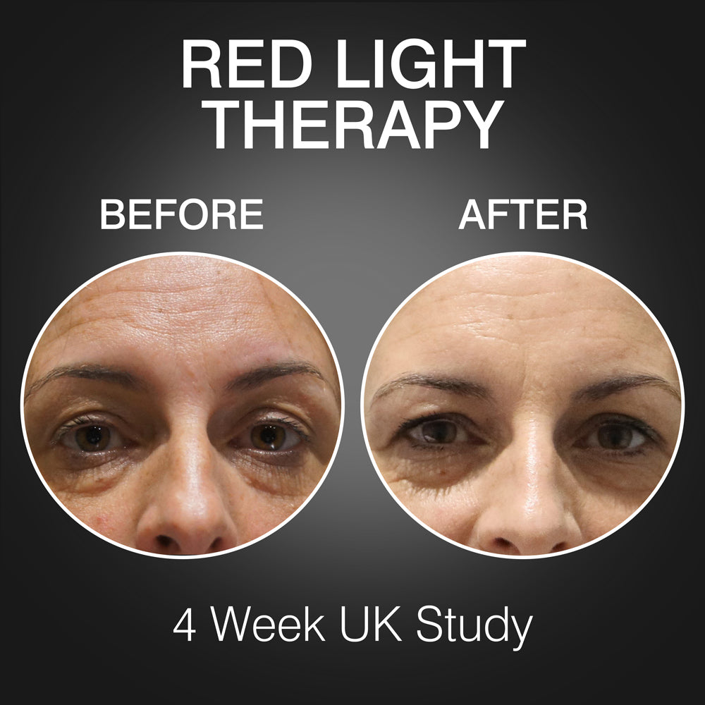 Side-by-side close-ups of a woman’s face labeled Before and After using Rio’s FaceGLO with Photology Chlorophyll Light Masque, showing visibly reduced wrinkles and smoother skin after 4 weeks. Text at top: RED LIGHT THERAPY.